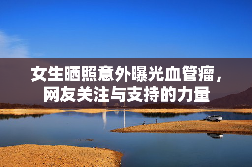 女生晒照意外曝光血管瘤，网友关注与支持的力量